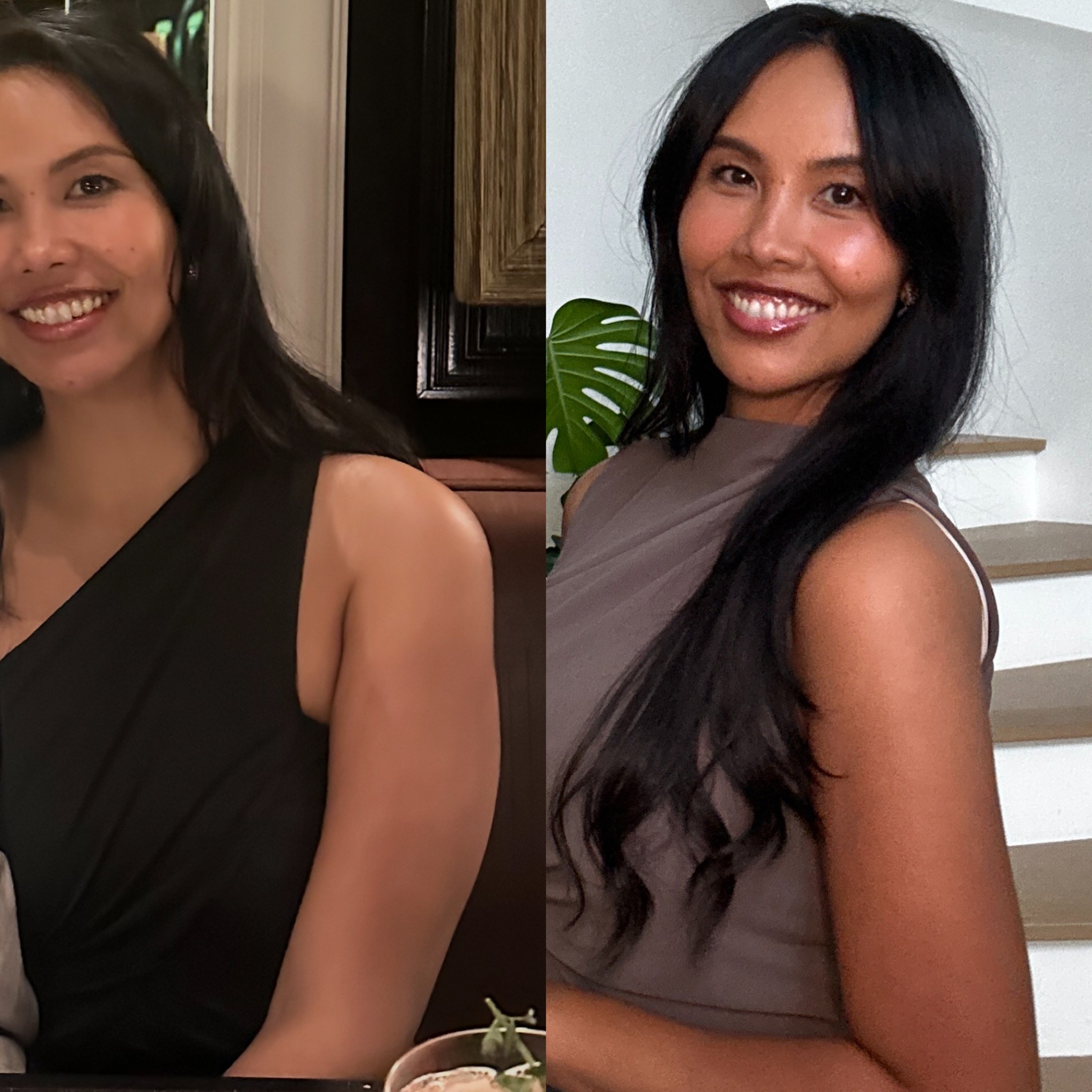 Vanessa Lee Onda Pro 治療前後的照片